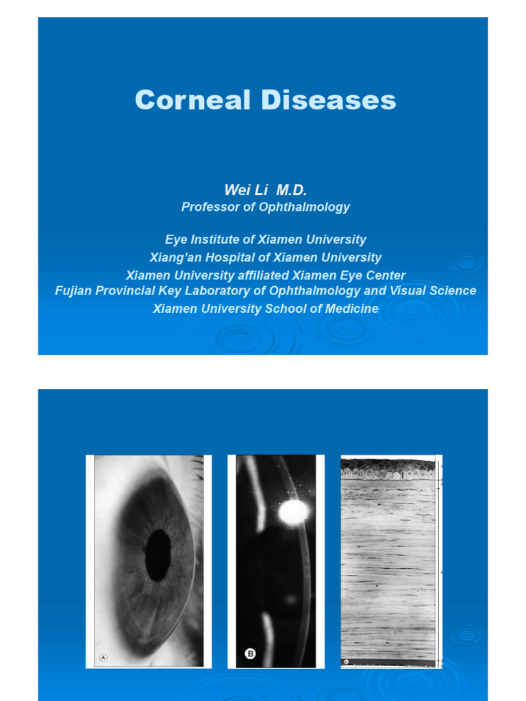 Overview of Corneal Diseases and Treatments | PDF | Cornea | Human Eye