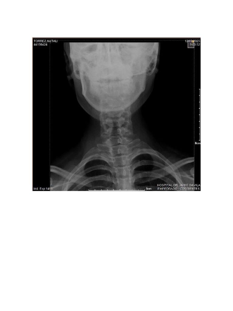 RX | PDF