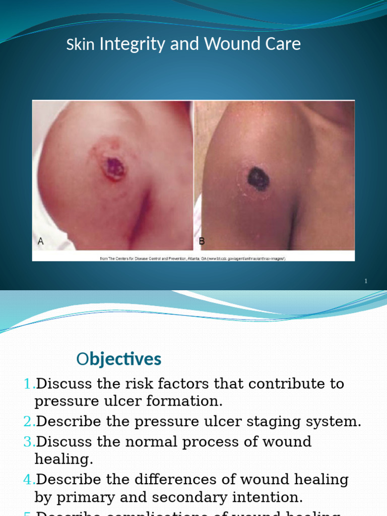 Pressure Ulcer Management and Wound Care | PDF | Wound | Skin