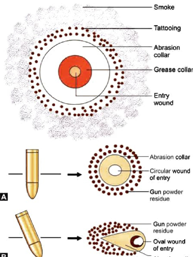 Gunshot Wound Features and Analysis | PDF | Gun Barrel | Firearms