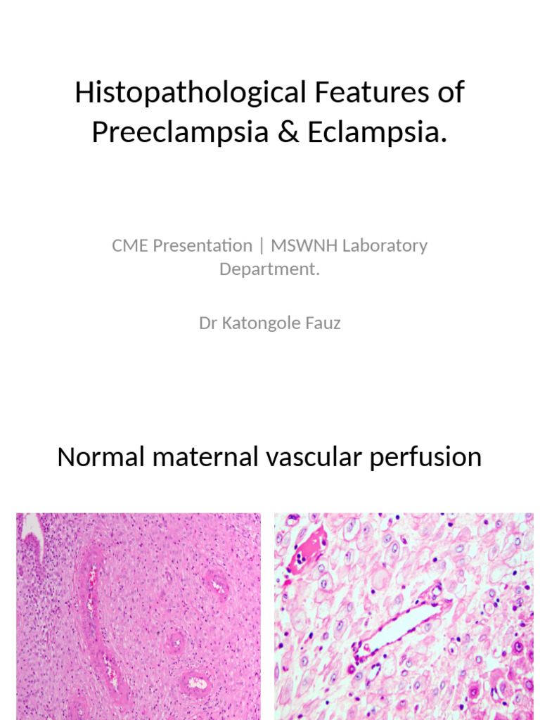 Histopathology - Preeclampsia - Eclampsia - CME - Images MSWNH 2025 | PDF