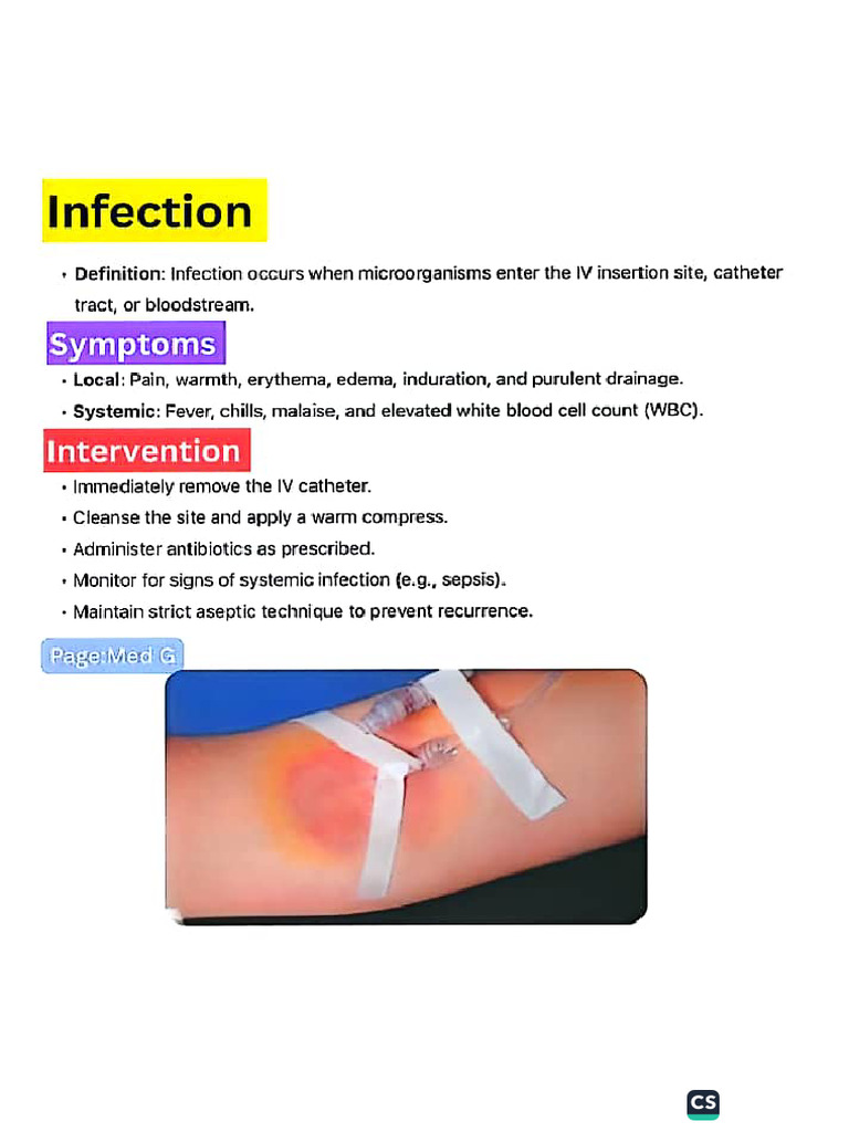 Intravenous (IV) Therapy, Their Complication | PDF