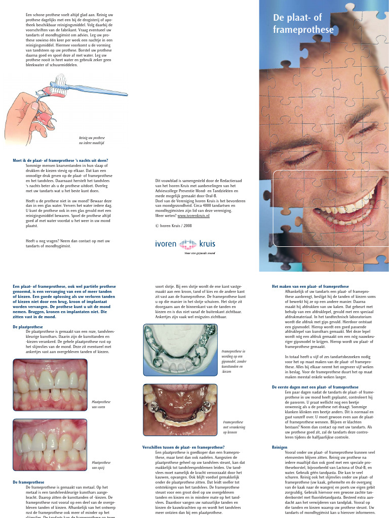 De Plaat - of Frameprothese | PDF