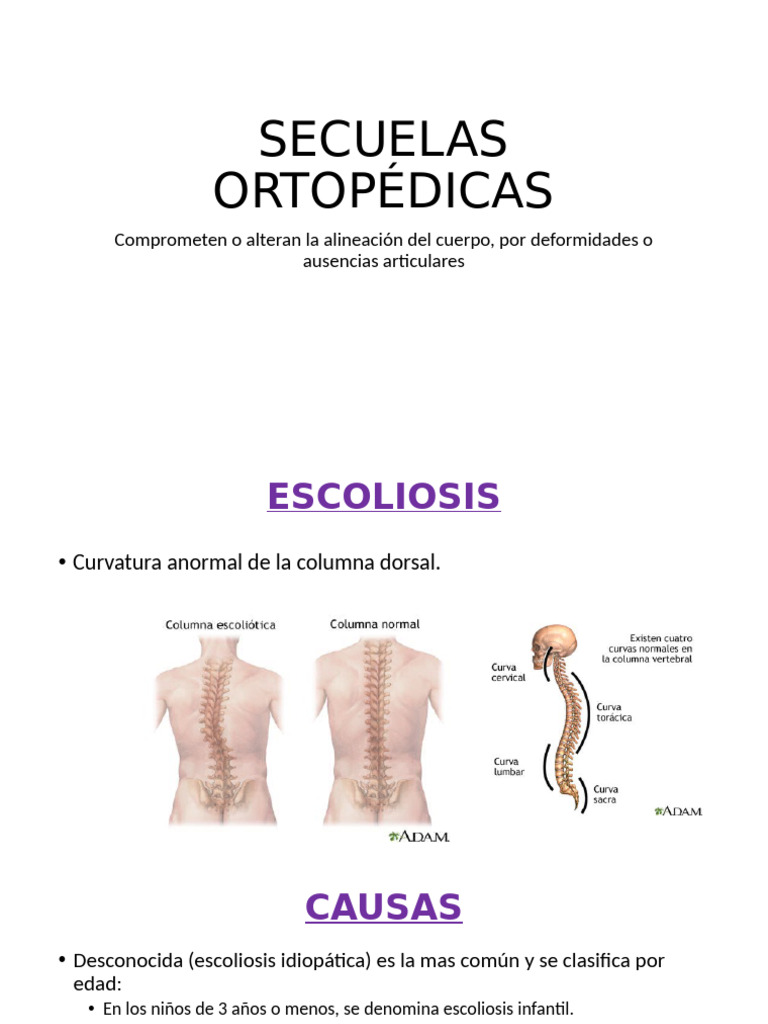 Secuelas Ortopédicas | PDF | Escoliosis | Sistema nervioso