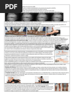 Eficiencia del Método Merchant en Rótula | PDF | Rodilla | Imagenes medicas