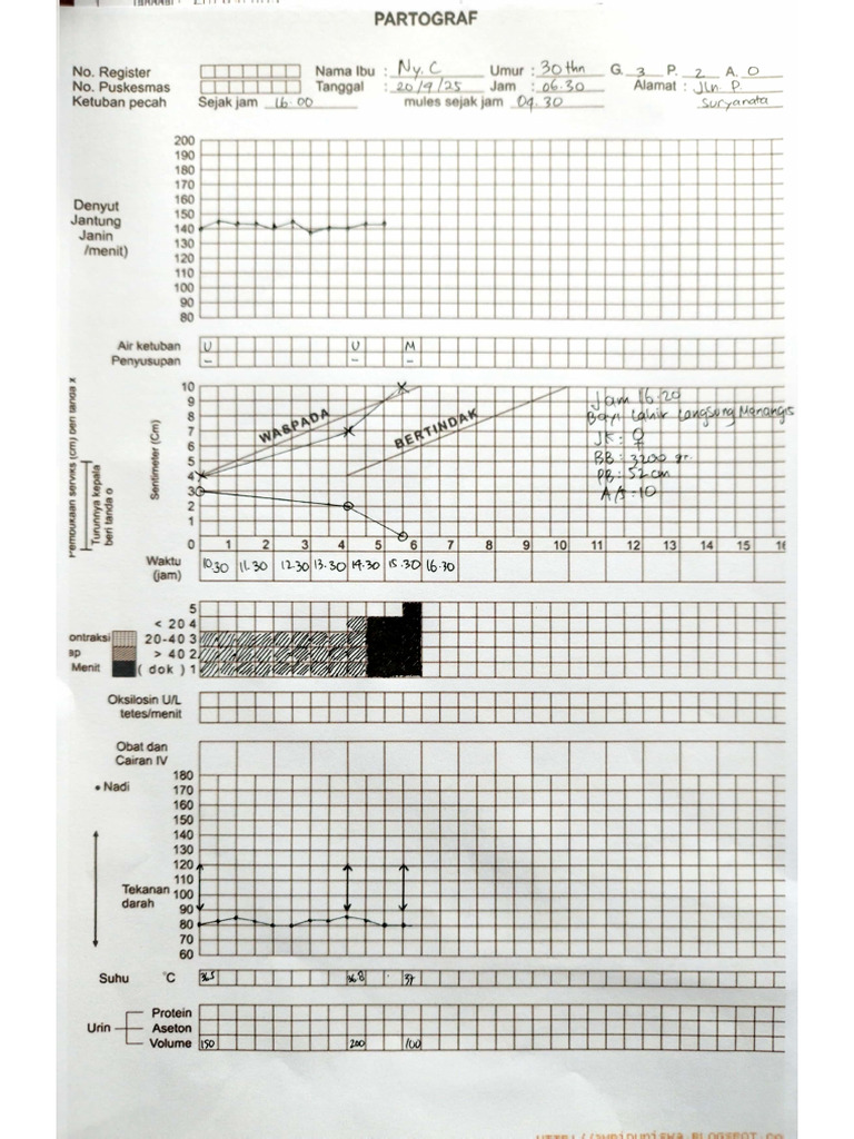 Tugas Partograf | PDF
