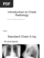 The Difference Between Chest Posterior Anterior (PA) and Anterior ...