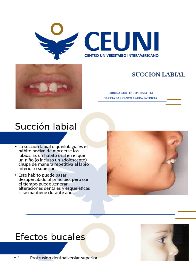 Ejercicios para succión labial | PDF | Labio