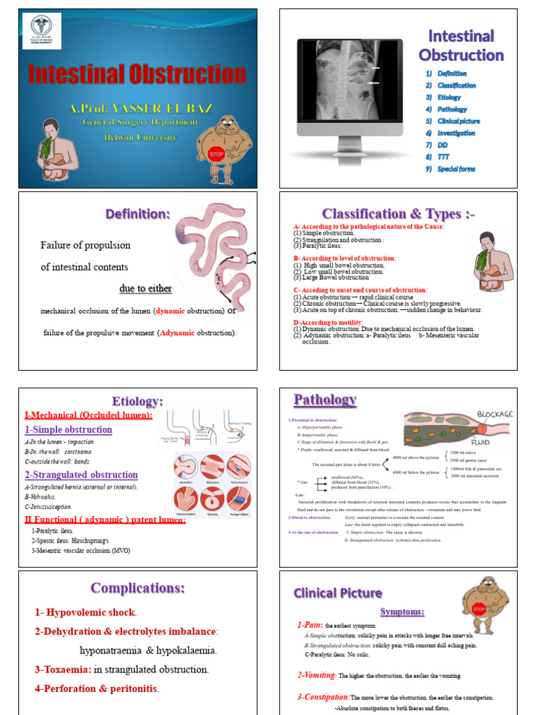 Understanding Intestinal Obstruction Types | PDF | Digestive System ...