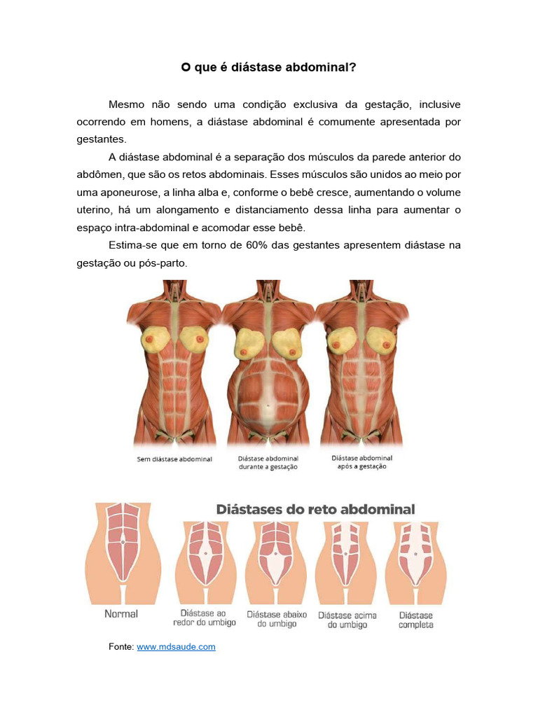Diastase Geafas | PDF | Gravidez | Pélvis, image size:768x1024