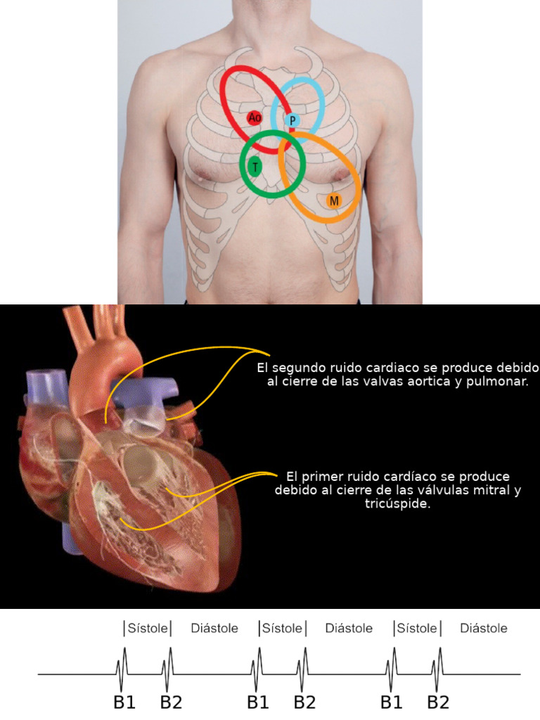 Ruidos Cardiacos | PDF | Corazón | Ventrículo (corazón)