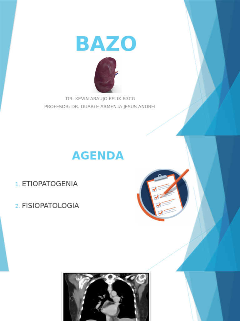 BAZO | PDF | Linfoma | Bazo