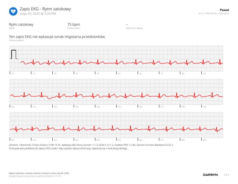 Garmin Ecg 30052025 08:00PM 30052025 30052025 | PDF