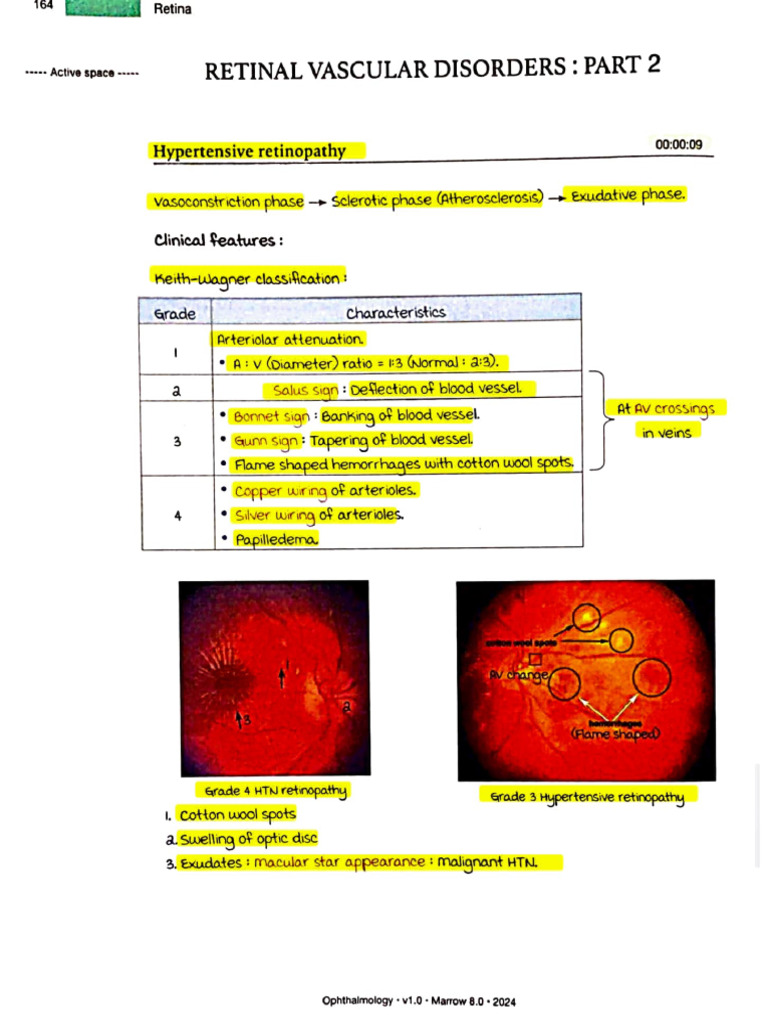 Retinal Vascular Disorders Overview | PDF | Glaucoma | Retina