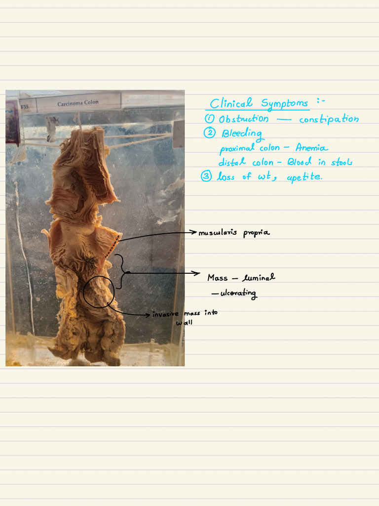 Pathology Specimens | PDF