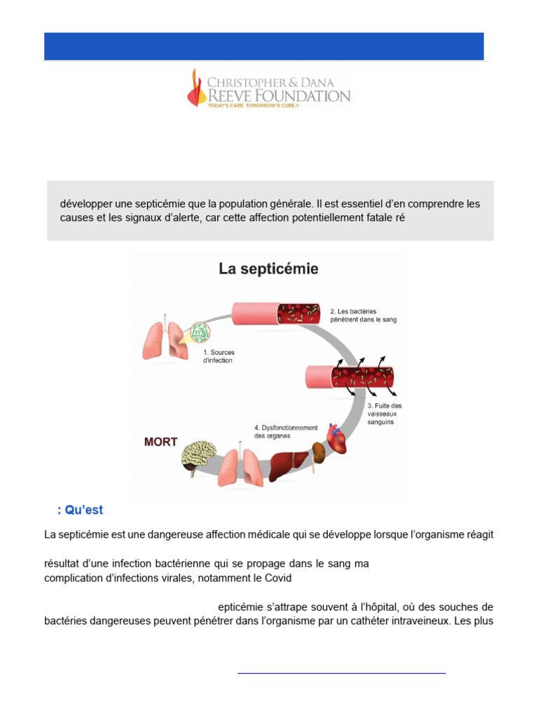 Comprendre la septicémie et ses signes | PDF | État septique | Infection