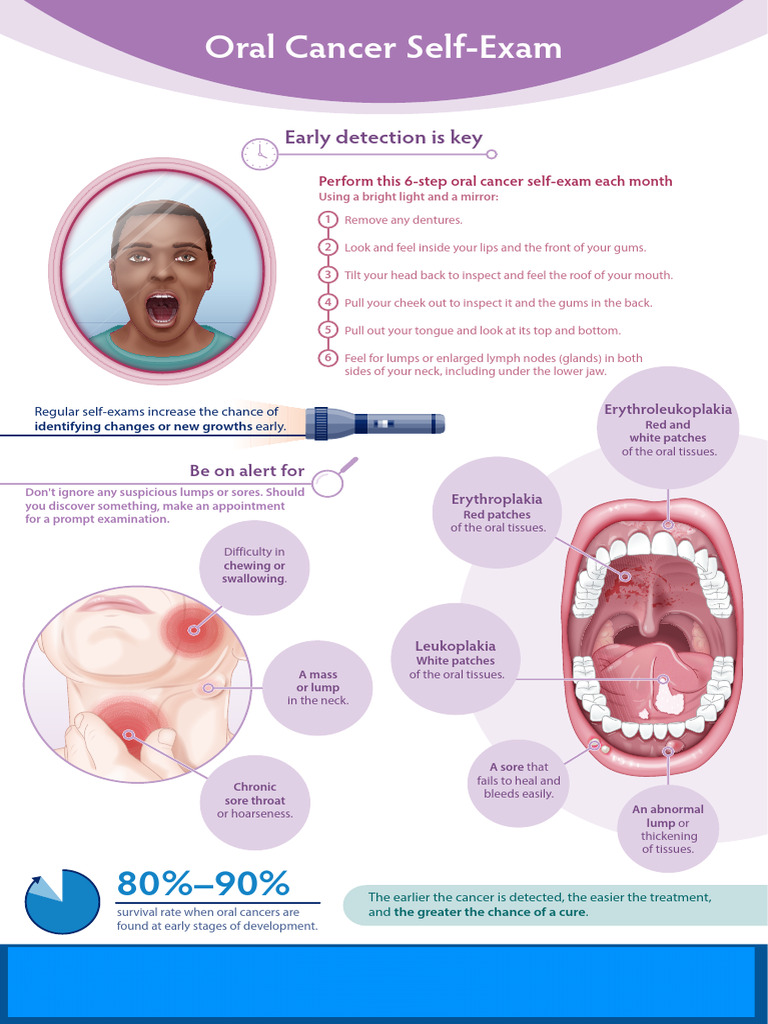 Oral Cancer | PDF | Cancer | Neoplasms