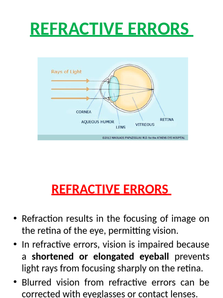 Understanding Refractive Errors | PDF | Cornea | Myopia