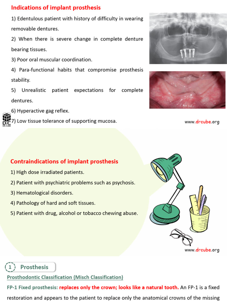 Updated Pros5 Lec.19 Implant Prosthesis | PDF | Dental Implant | Dentistry