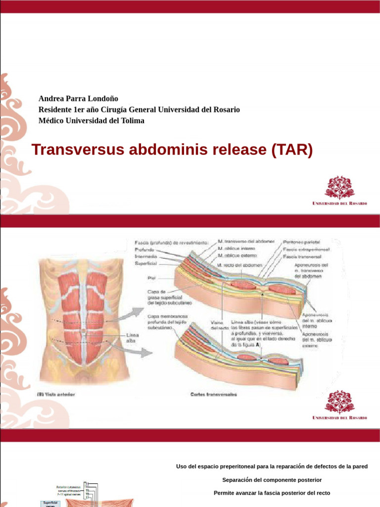 Laparoscopic TAR for Abdominal Repair | PDF