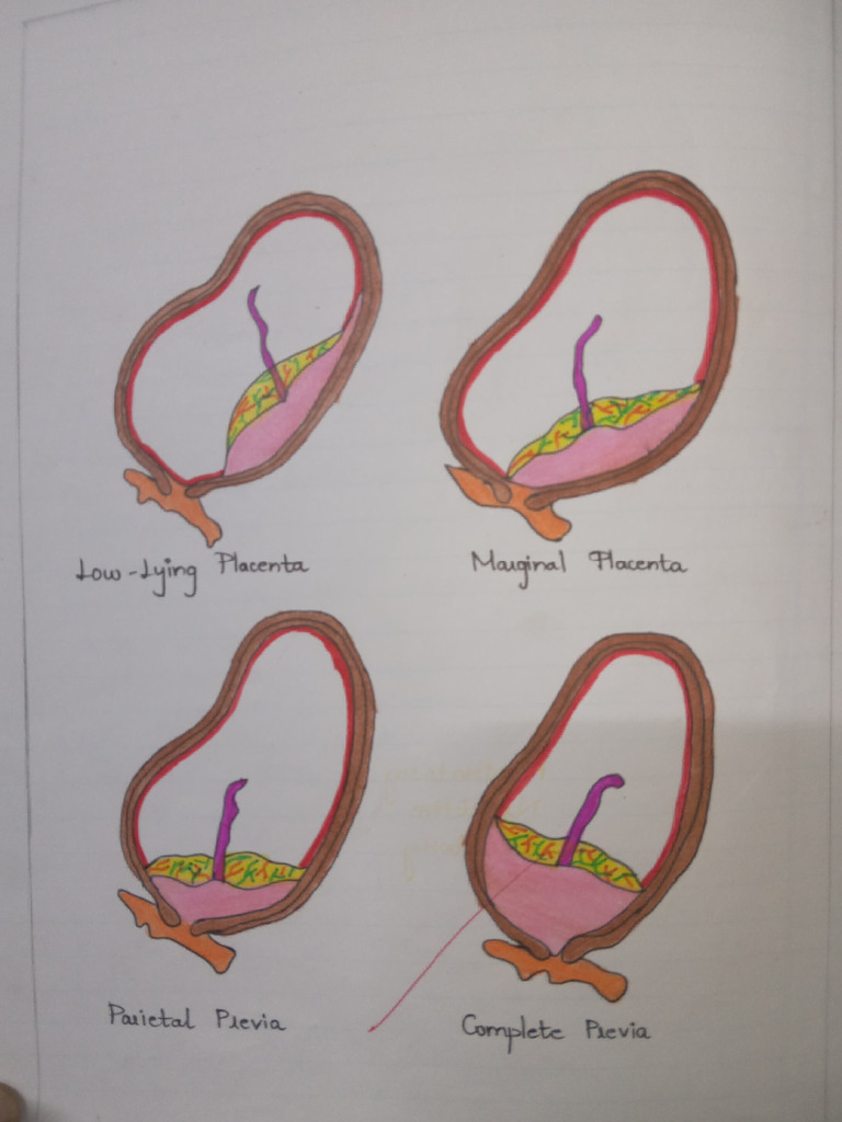 Angiology Scan of Placental Function | PDF | Angiology | Cardiovascular ...