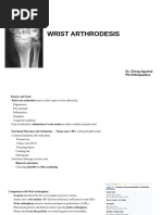 Arthrex Mini CFS Plates Overview | PDF | Magnetic Resonance Imaging ...