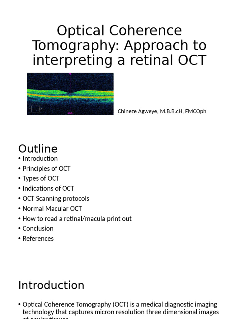Interpreting Retinal OCT: A Comprehensive Guide | PDF | Retina ...