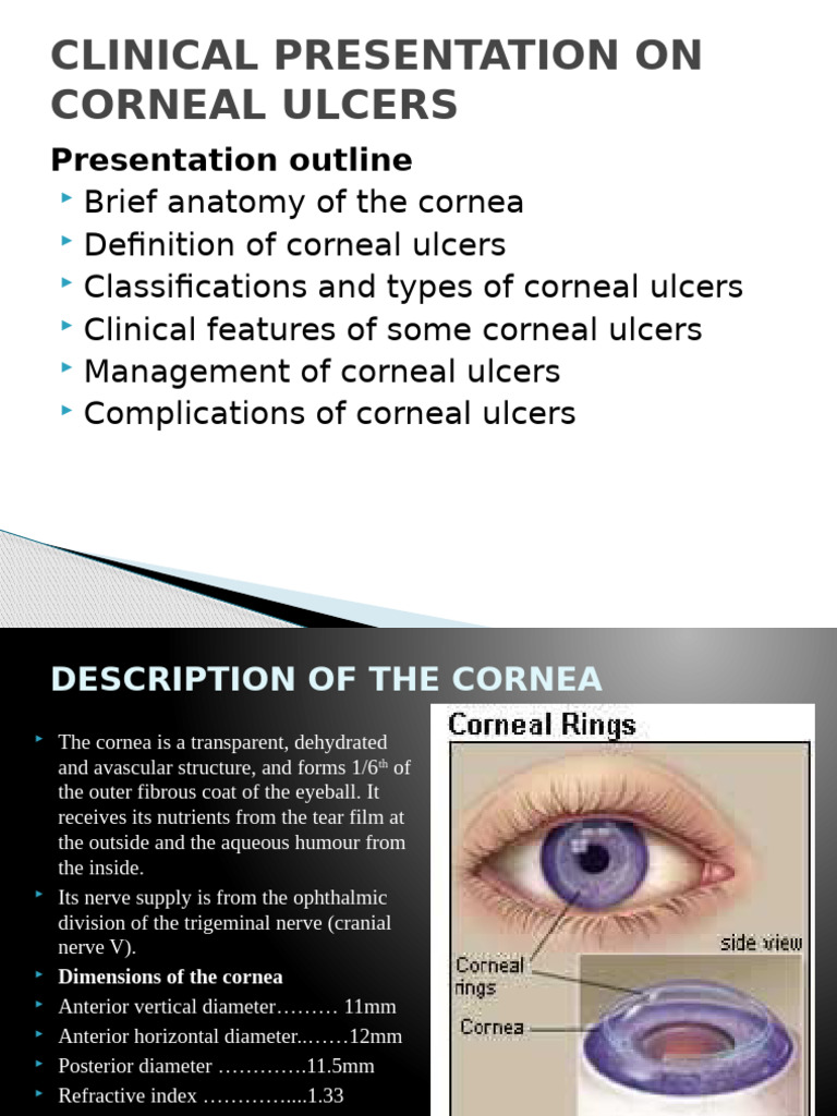 Corneal Ulcer DLD | PDF | Cornea | Diseases And Disorders