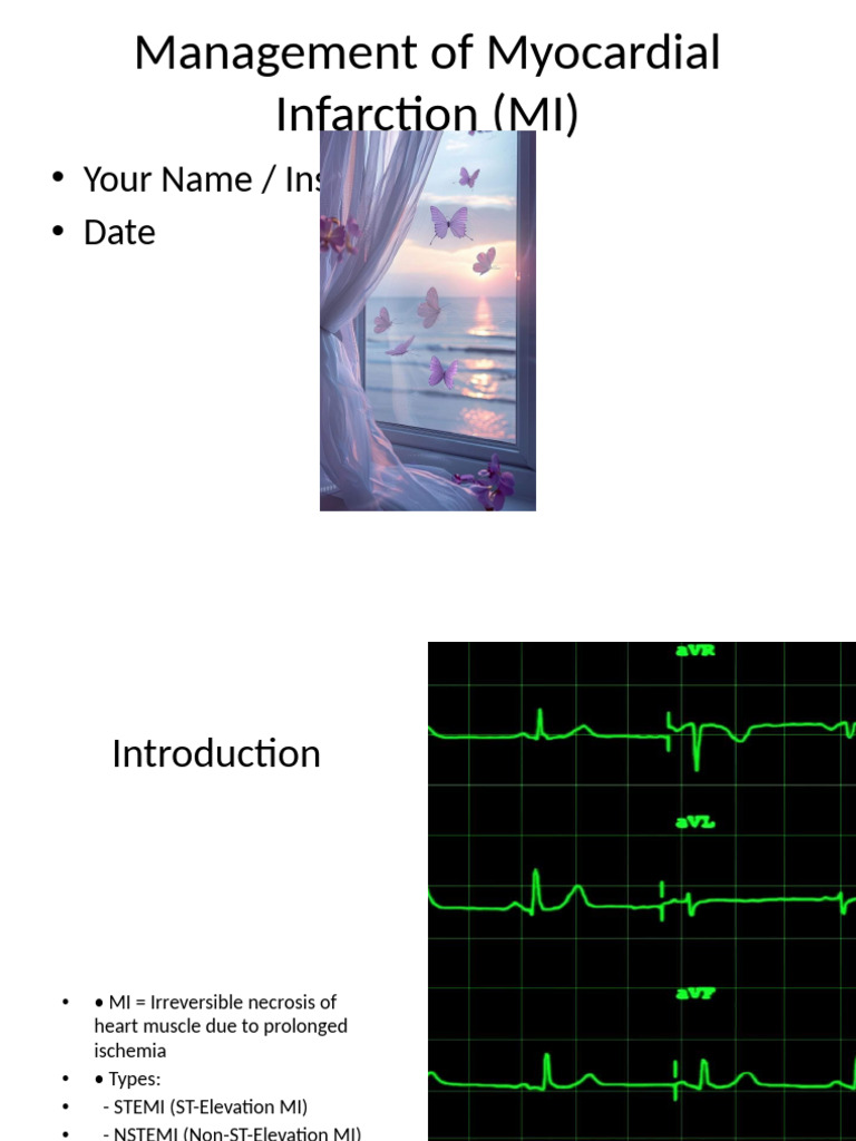 Management of MI Presentation | PDF