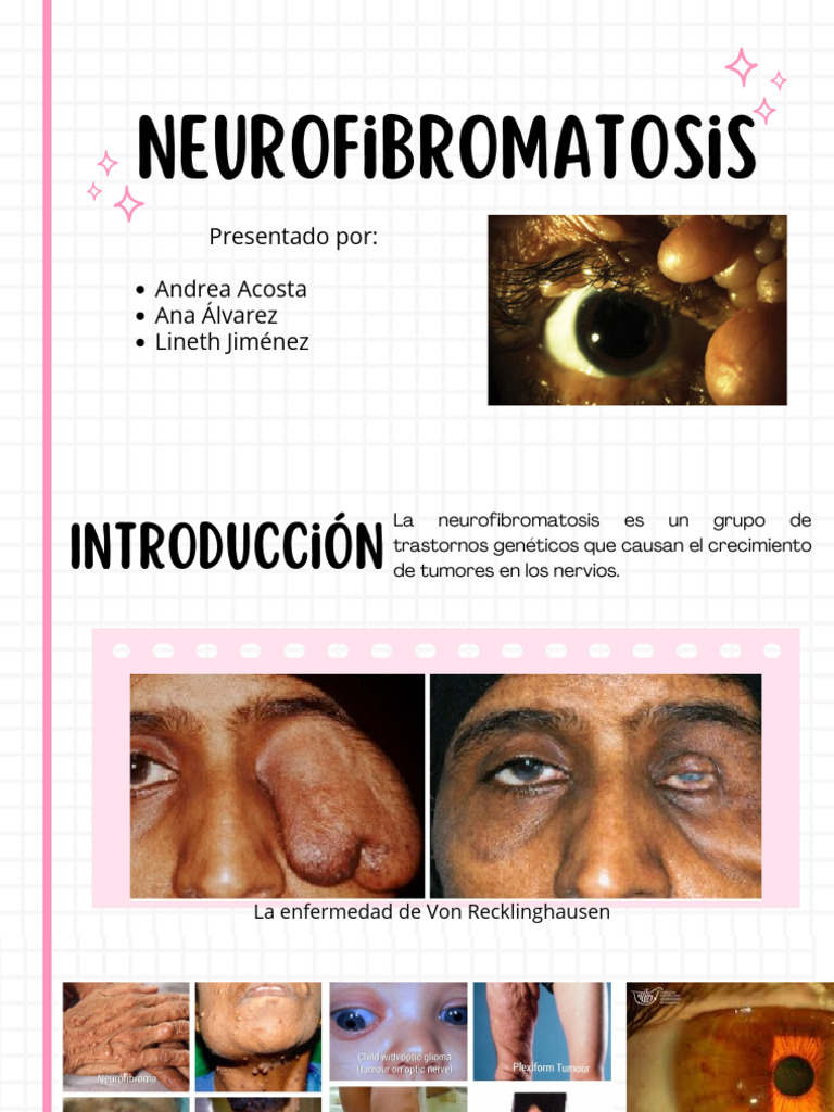 neurofibromatosis-tipos-y-diagn-stico-pdf-enfermedades-y