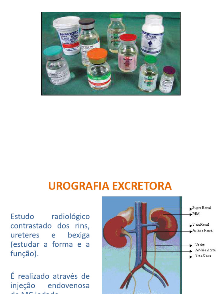 Aula 1 - MC - Urografia Excretora | PDF