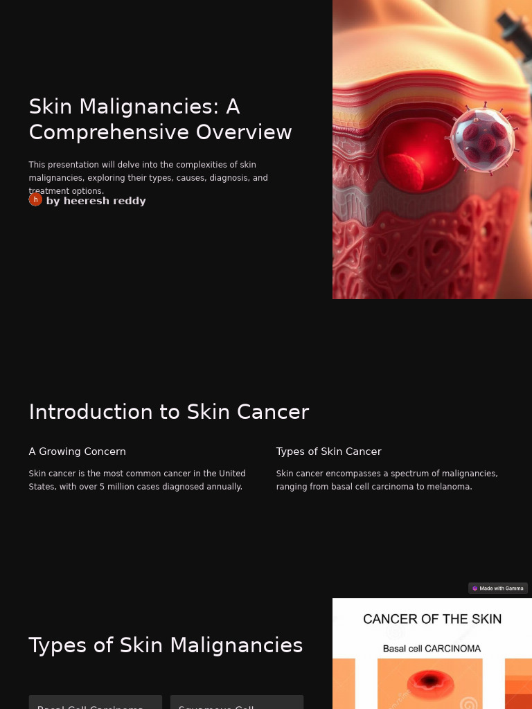 Skin Malignancies A Comprehensive Overview | PDF | Skin Cancer | Cancer