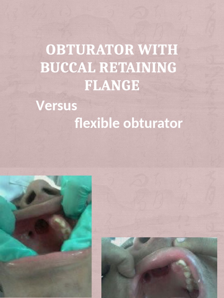 Obturator With Buccal Retaining Flange | PDF