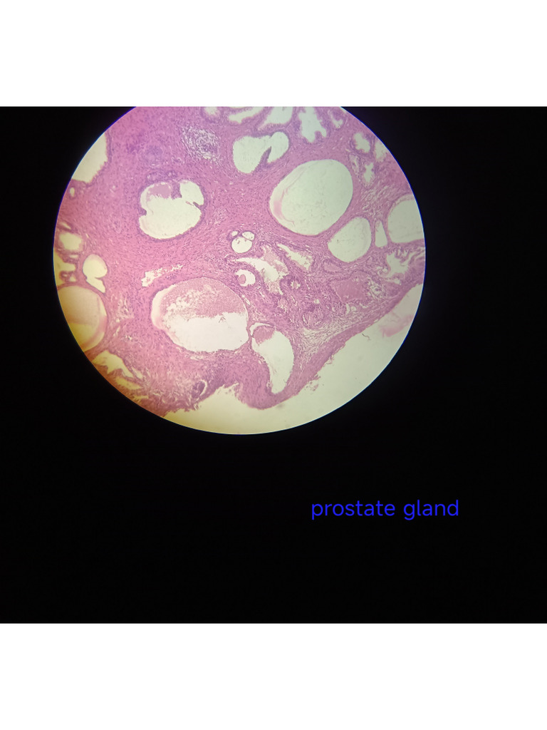 Prostate+ Mammary | PDF