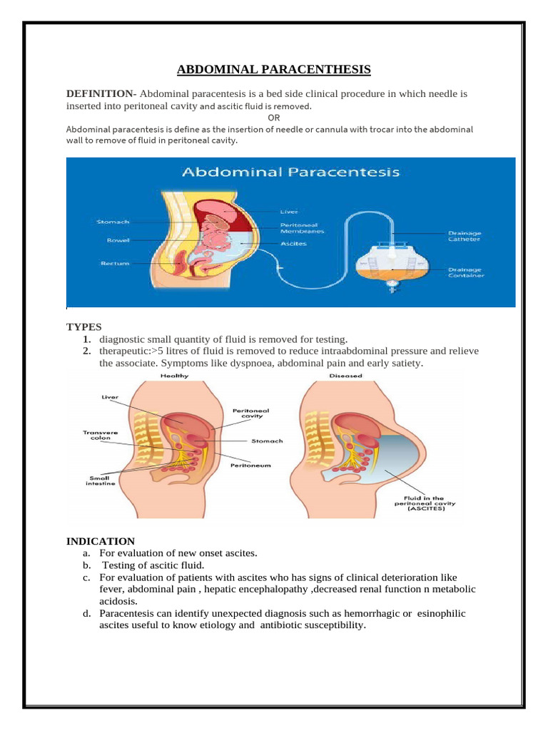 Abdominal Paracentesis Procedure Guide | PDF | Medical Specialties ...