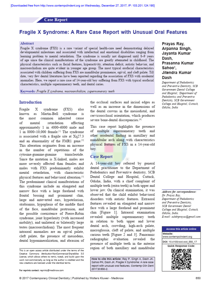Fragile X Syndrome A Rare Case Report With Unusual | PDF | Diseases And ...