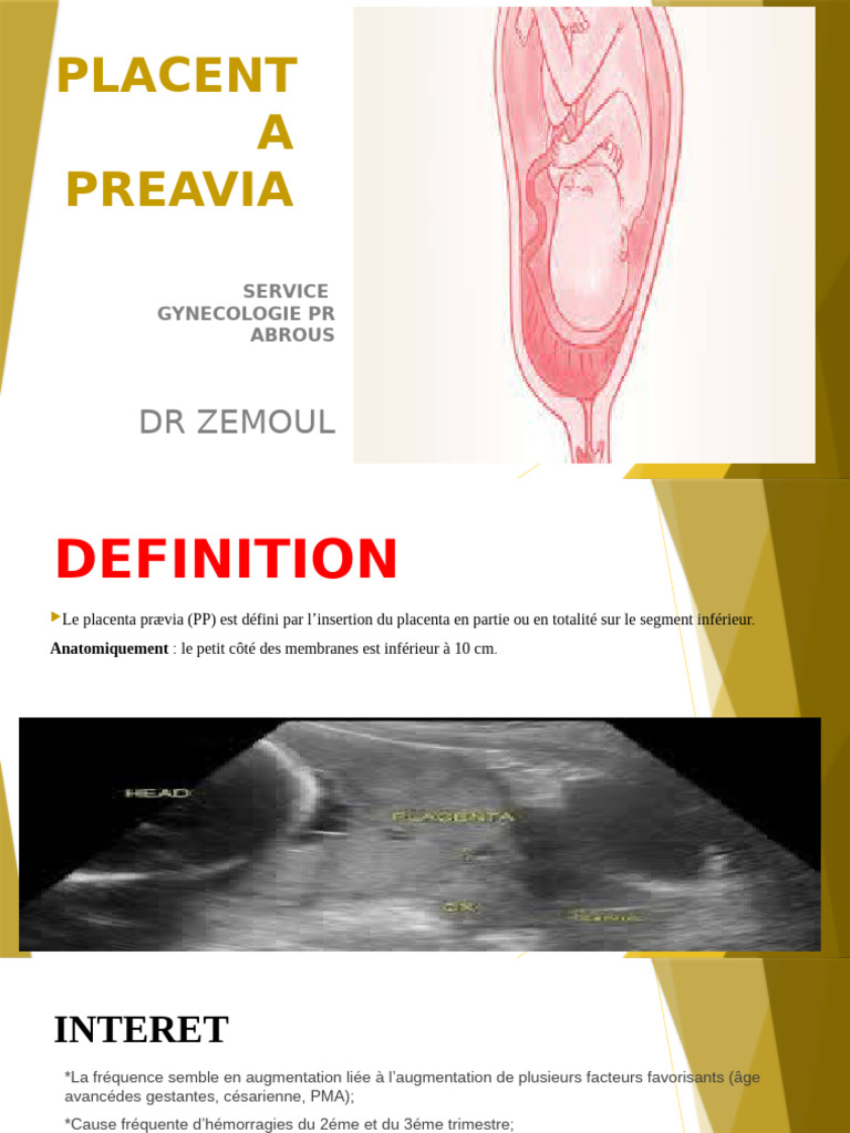 Placenta Prævia : Diagnostic et Risques | PDF | Accouchement | Grossesse