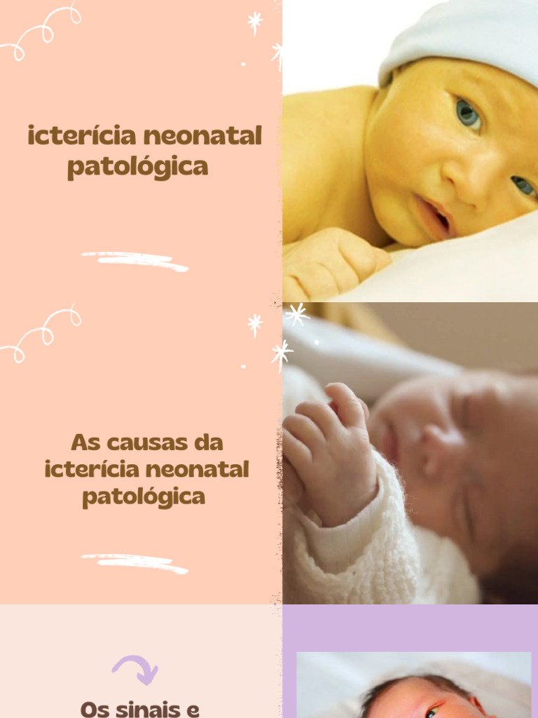 Causas e Tratamento da Icterícia Neonatal | PDF
