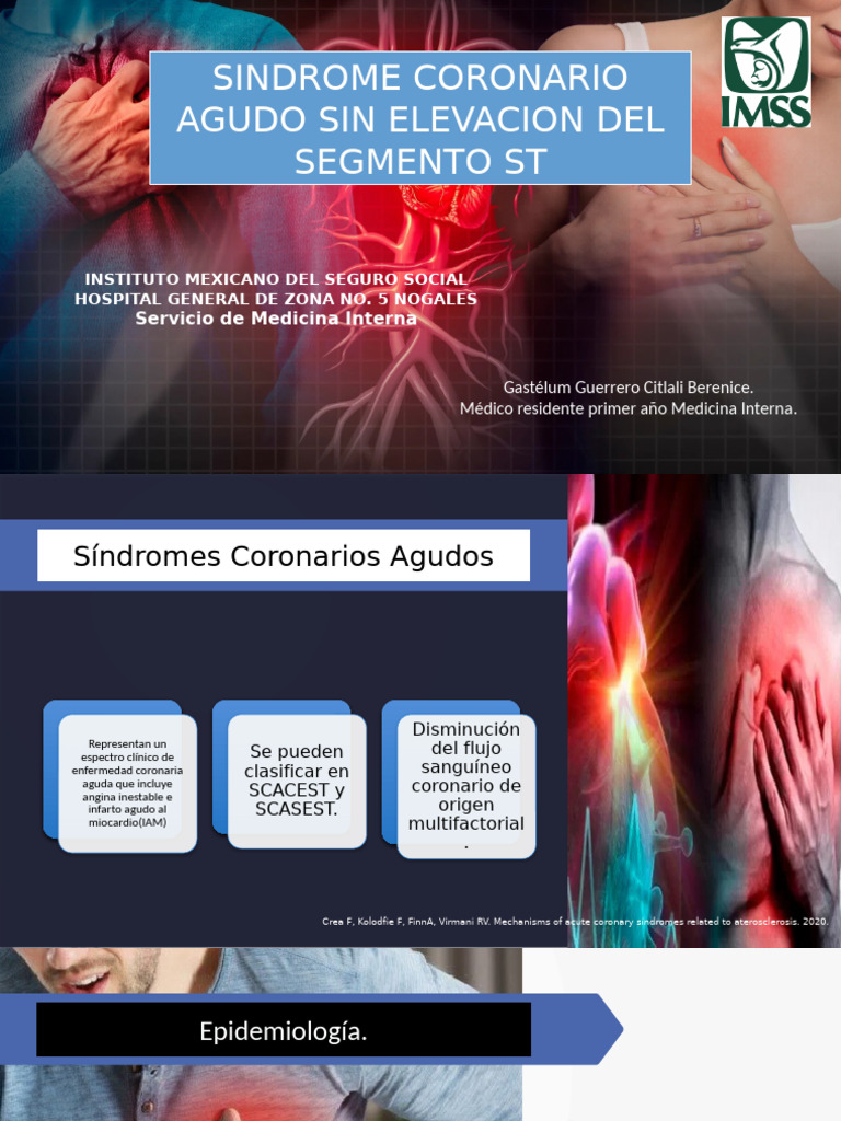 Infarto Sin Elevacion | PDF | Infarto de miocardio | Especialidades Medicas