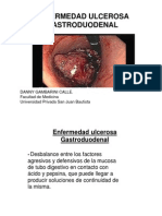 ulcera gastroduodenal