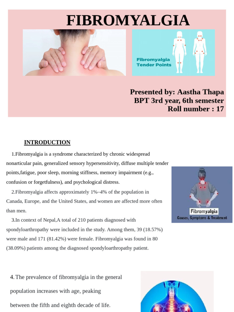 Fibromyalgia Insights by Aastha Thapa | PDF | Fibromyalgia | Randomized ...