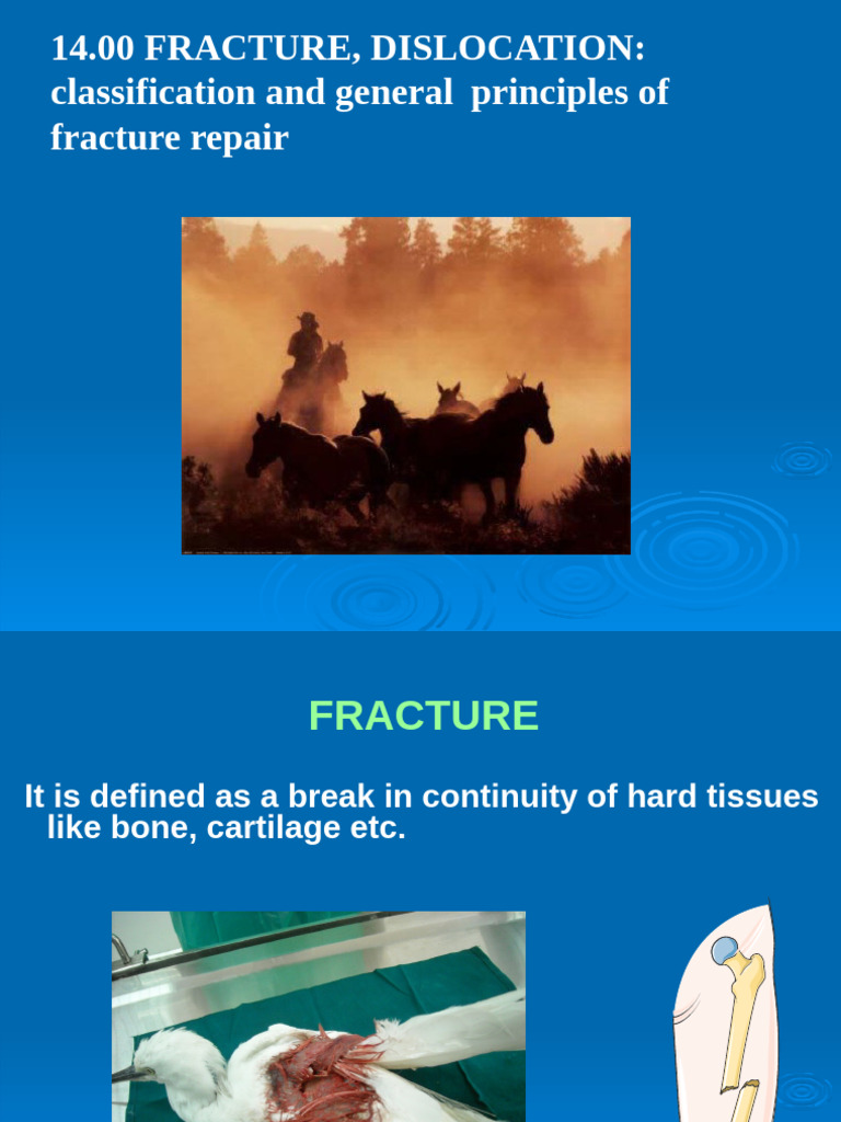 14.00 Fracture & Dislocation | PDF | Bone | Joint