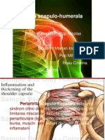 Periatrita Scapulo-Humerala: Prof - Coordonator: Pop Nicolae