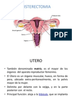 HISTERECTOMIA