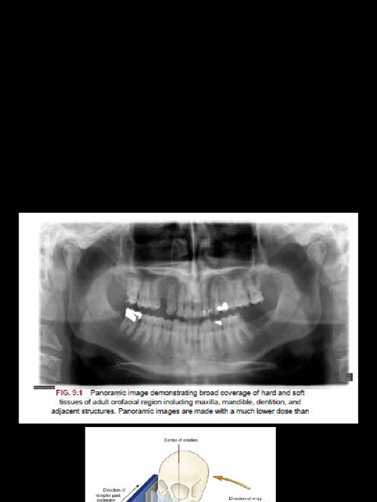 Epiglottis in Panoramic Radiographs | PDF | Primate Anatomy | Human Anatomy