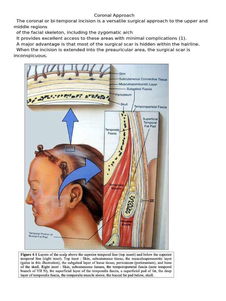 Coronal Approach to Facial Surgery | PDF