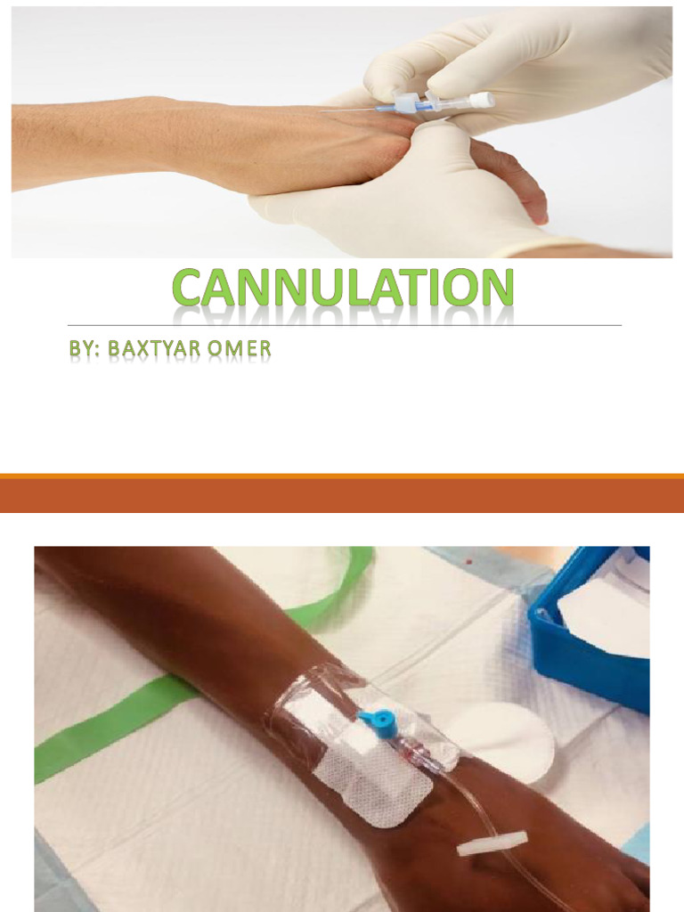 Canulation | PDF | Intravenous Therapy | Vein