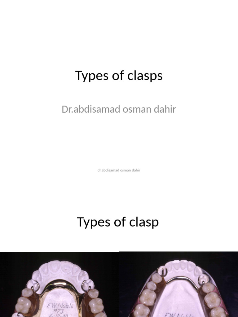 Types of Multiple Circlet Clasps | PDF | Dentures | Dentistry Branches