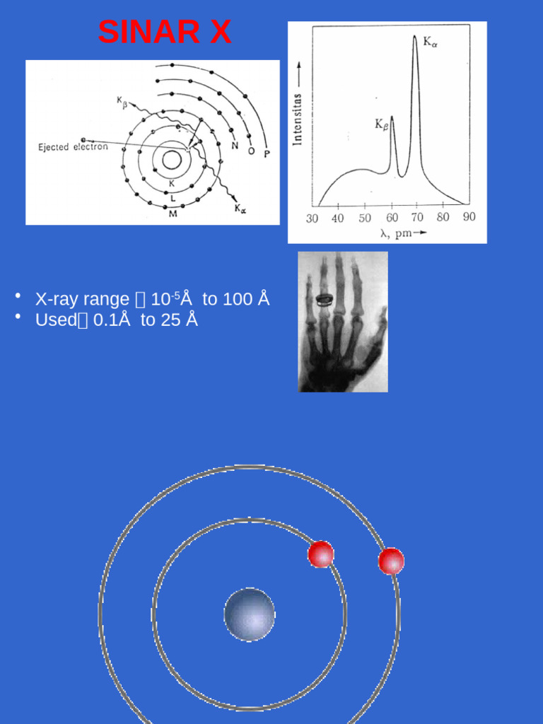X Rays | PDF