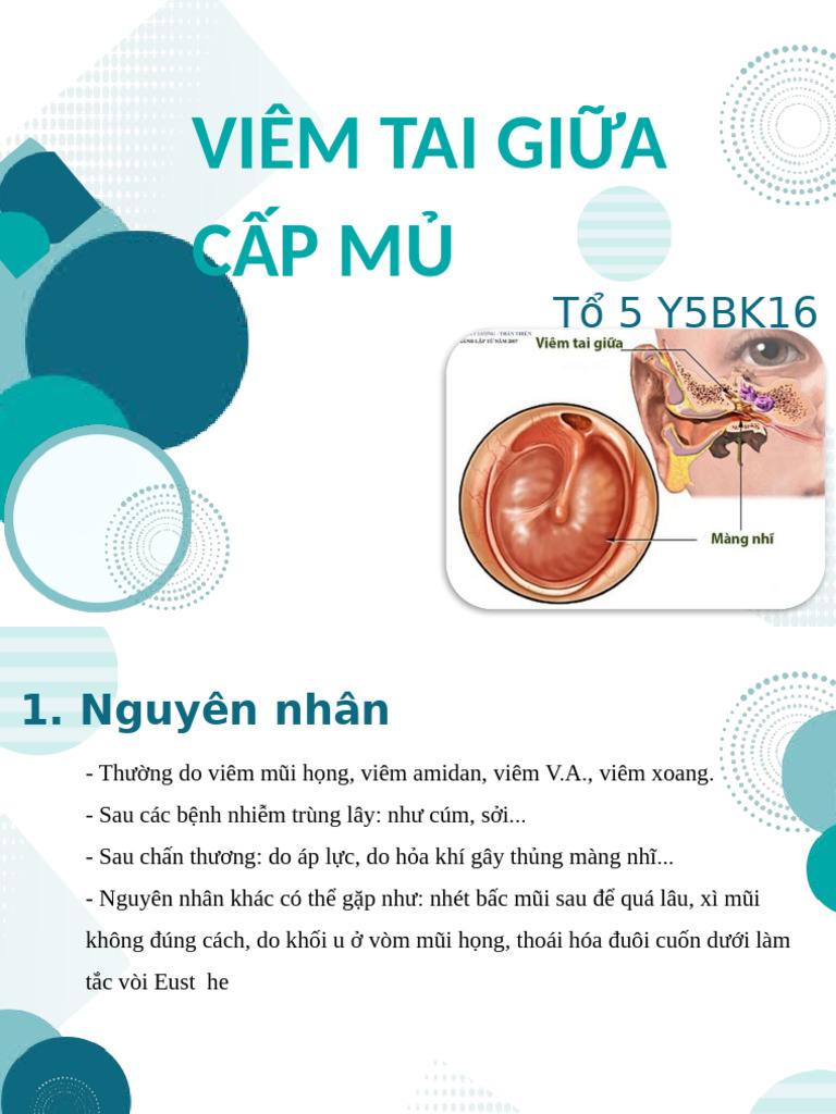 VIêm tai giữa cấp mủ 2 | PDF